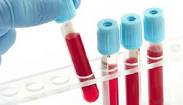 Группы крови и резус-фактор. Методы определения и совместимость