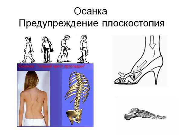 
    Урок "Осанка. Предупреждение плоскостопия". 8-й класс

      